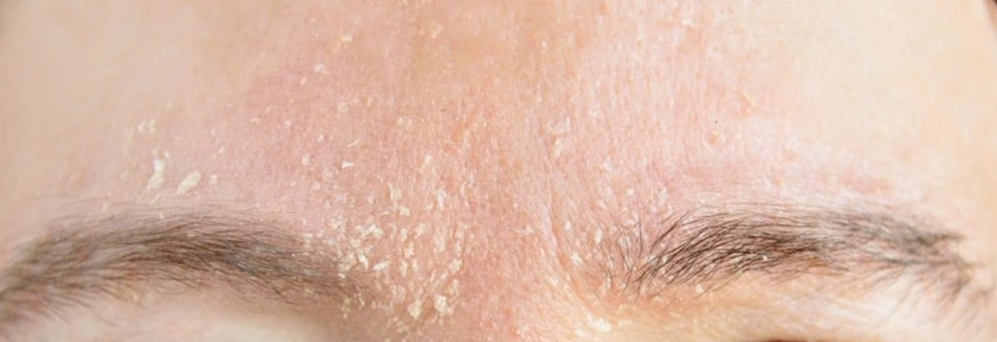 Early Winter, Revitalize Your Skin: Hair & Soul Wellness Hub's Seasonal Facial Treatments